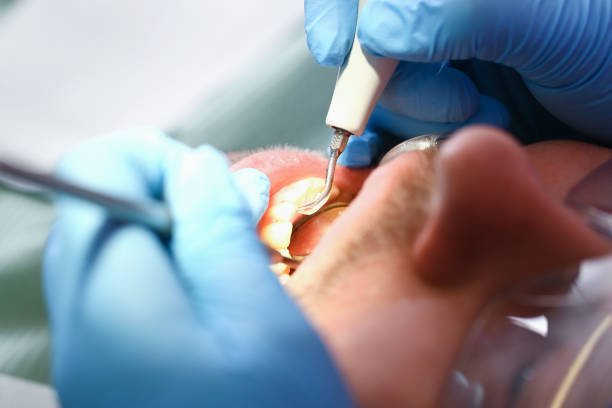 Best Urgent Care for Lost Fillings or Crowns in Desoto, TX